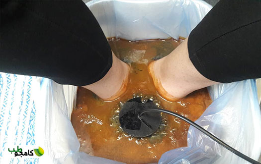 رنگ آب سم زدایی و کانال های یونی