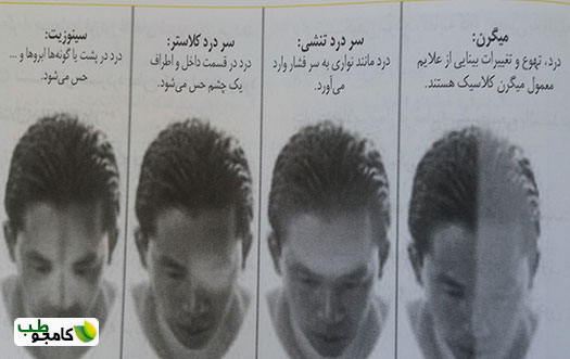 انواع سر درد