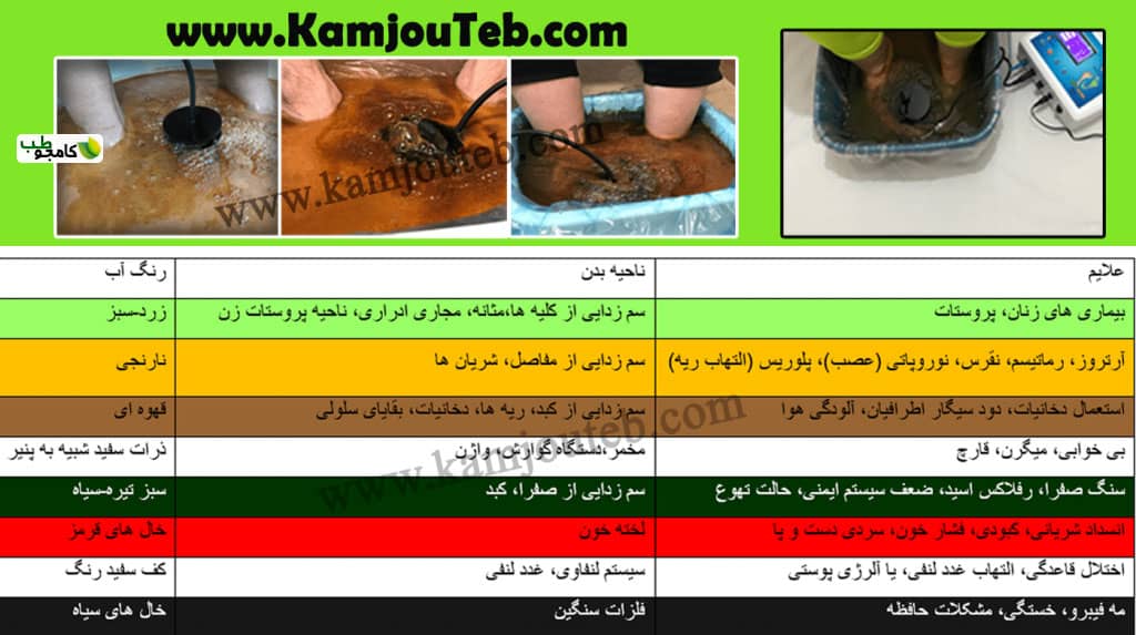نمودار رنگ دستگاه سم زدایی بدن