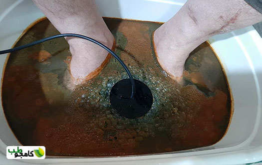 سمزدایی بدن با دستگاه