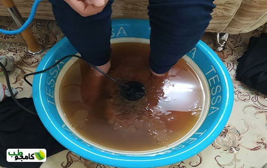 سم زدایی یونی از طریق پا
