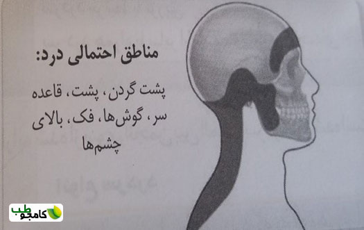 سردرد میگرن